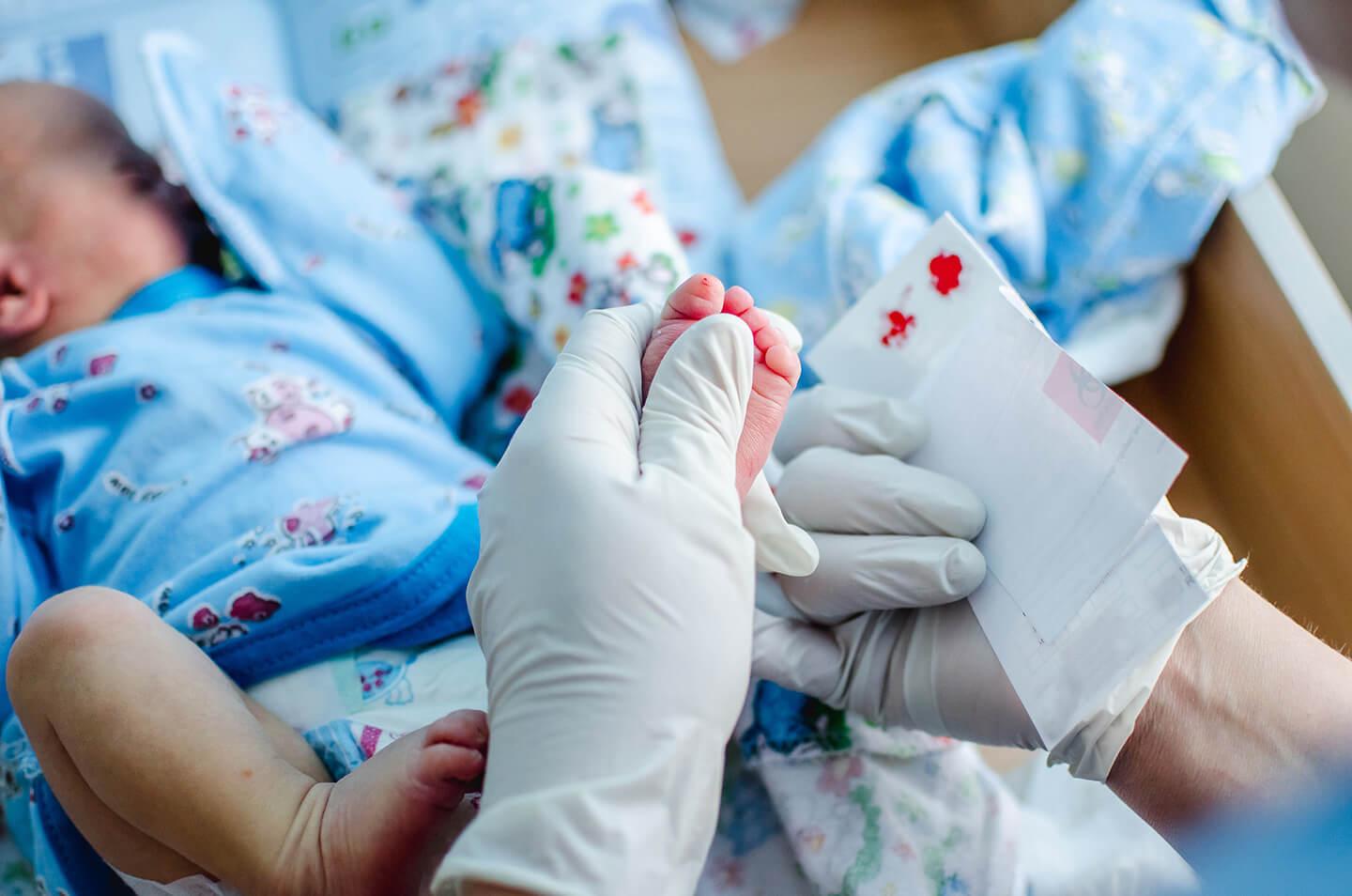 Hospitais podem ser obrigados a fazer teste de cariótipo em recém-nascidos